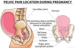 Pelvic Pain Location During Pregnancy Picture