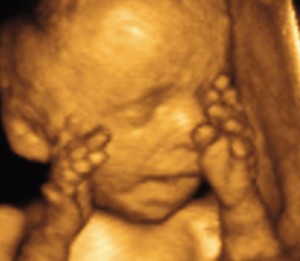 Third Trimester Ultrasound