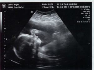 23 Weeks Pregnant Ultrasound Picture