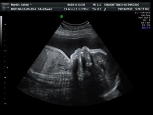 28 Weeks Pregnant Ultrasound Picture