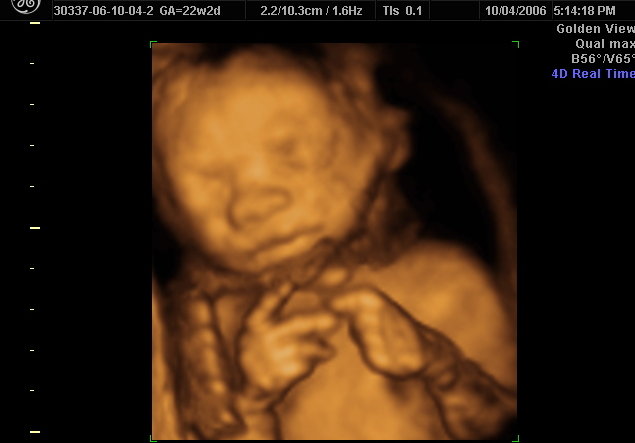 30 Weeks Pregnant Ultrasound Image
