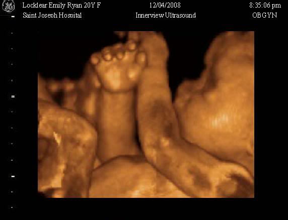 34 Weeks Pregnant Ultrasound Picture