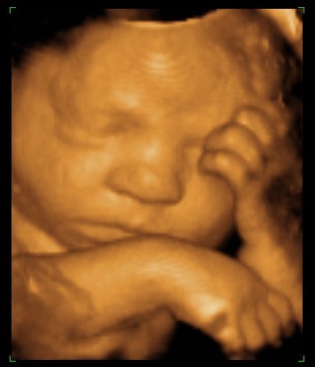 35 Weeks Pregnant Ultrasound Picture