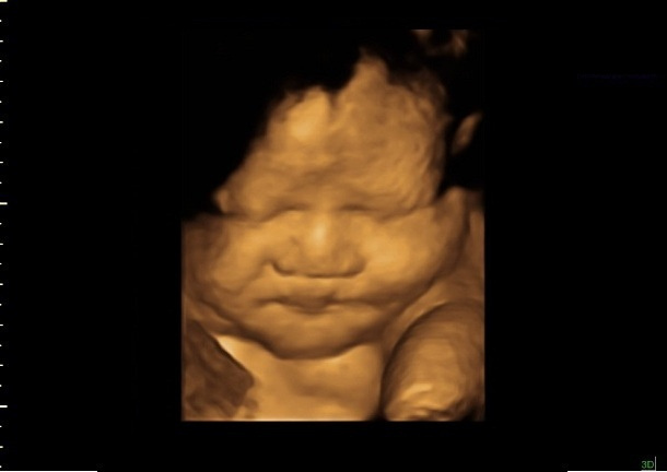 37 Weeks Pregnant 3D Ultrasound Picture