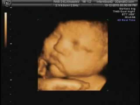 38 Weeks Pregnant Ultrasound Picture