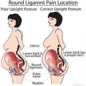 Round Ligament Pain Location
